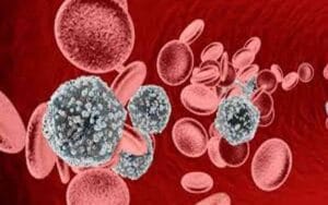 HIV-AND-AIDS.jpg