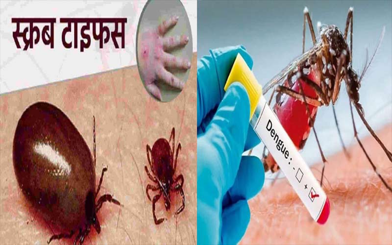 हिमाचल में स्क्रब टायफस के 723 मरीज पॉजिटिव, अब तक इतने लोगों की हुई मौत….