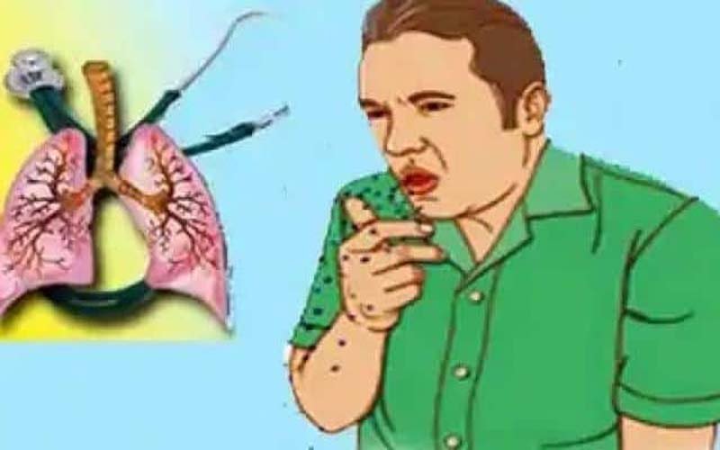 TB Free Himachal Campaign