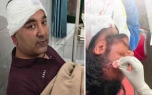 Bloody clash between Congress and BJP supporters, attacked with Plas and screwdriver