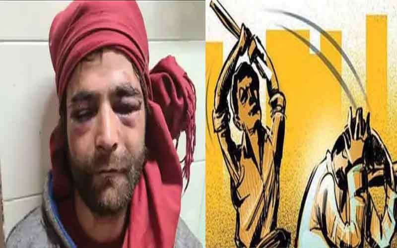 कांग्रेस और भाजपा कार्यकर्ताओं के बीच मारपीट, एक बुरी तरह घायल