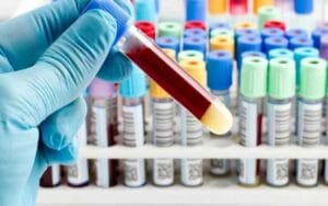 Blood-samples-of-patients-w.jpg