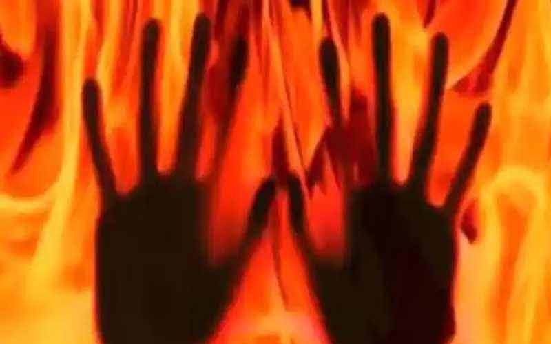 आग की चपेट में आने से बुरी तरह झुलसी मां-बेटी, अस्पताल में भर्ती