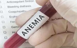This district is at the forefront to make anemia free, much more than the set target…..