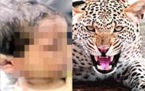 Leopard-attacked-8-year-old.jpg