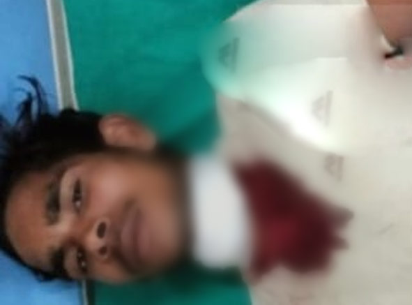 चाकू से 17 वर्षीय युवक का गला रेतकर बदमाश हुए फरार