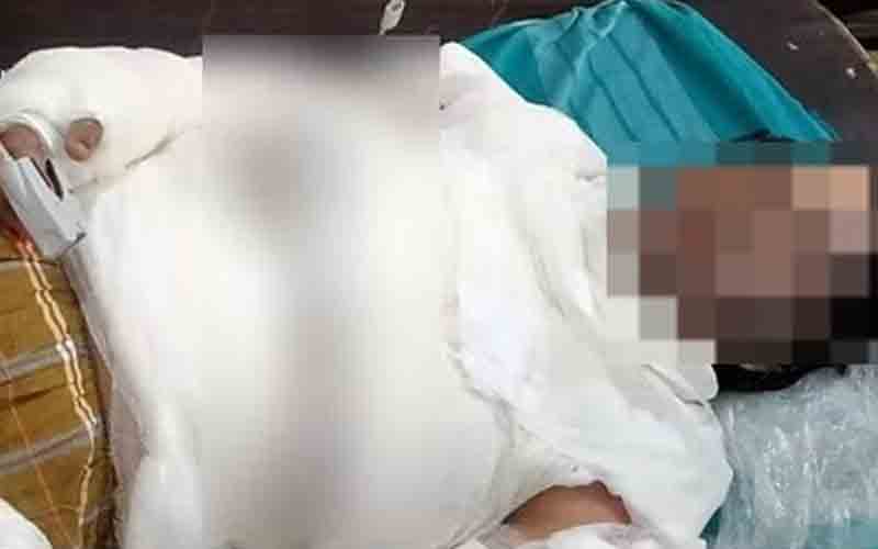 पत्नी ने अपने पति की आँखों में लाल मिर्ची पाउडर डालकर लगा दी आग, पीजीआई रेफर