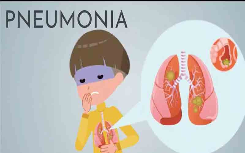 मंडी जिले में दस्त व निमोनिया नियंत्रण पखवाड़े का दूसरा चरण