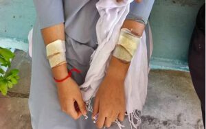 Schoolgirl-attacked,-masked
