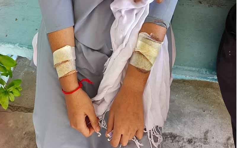 स्कूली छात्रा पर हमला, नकाबपोश युवक फरार