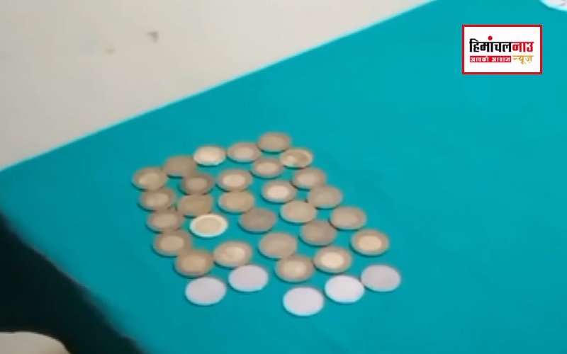हिमाचल में हैरान करने वाला मामला, युवक के पेट से निकले 33 सिक्के